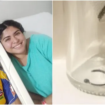 Piercing joj zavr&scaron;io u plućima na pola milimetra od aorte: 'Užas koji ne bih poželjela nikome'