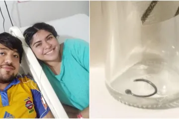 Piercing joj zavr&scaron;io u plućima na pola milimetra od aorte: 'Užas koji ne bih poželjela nikome'