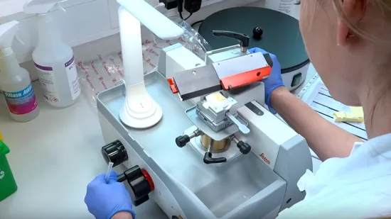 Revolucija u liječenju raka: 'Da sam se 10 godina rodila ranije, ni&scaron;ta od ovog ne bi bilo'