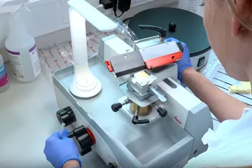 Revolucija u liječenju raka: 'Da sam se 10 godina rodila ranije, ni&scaron;ta od ovog ne bi bilo'