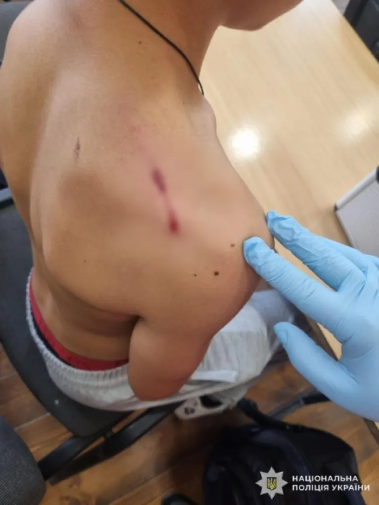 Pucnjava u ukrajinskoj &scaron;koli: Učenik pi&scaron;toljem prijetio razredu pa ranio vr&scaron;njaka