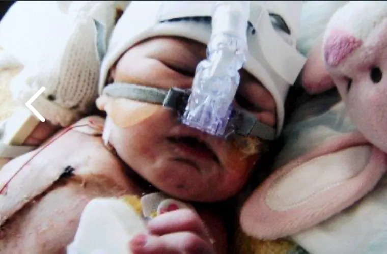 Preživjela je moždani udar i &scaron;est operacija srca i kralježnice: 'Ponosna sam na svoje ožiljke'