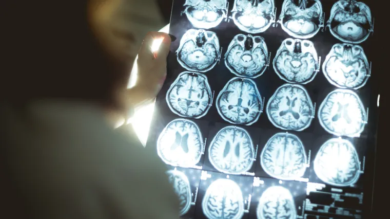 Ženu glasovi u glavi upozorili da ima tumor na mozgu, ispostavilo se da su bili u pravu!