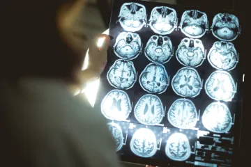 Ženu glasovi u glavi upozorili da ima tumor na mozgu, ispostavilo se da su bili u pravu!