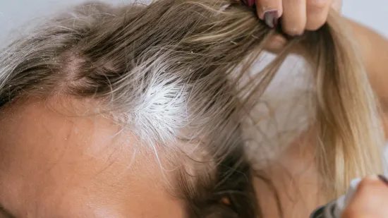 I vi ovako 'perete kosu'? Evo za&scaron;to ćete dvaput promisliti prije nego &scaron;to to opet napravite