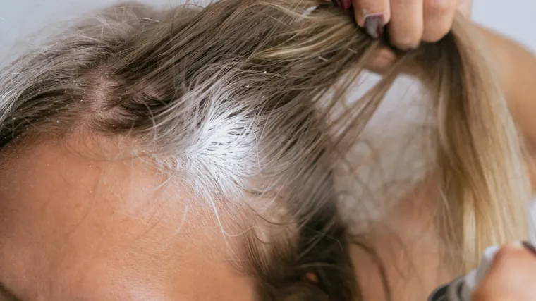 I vi ovako 'perete kosu'? Evo za&scaron;to ćete dvaput promisliti prije nego &scaron;to to opet napravite