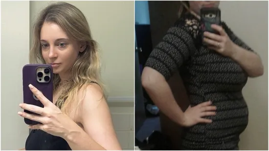 Nakon poroda nije mogla smr&scaron;avjeti, dijagnozu je otkrila slučajno: 'Osjećala sam jaku bol'