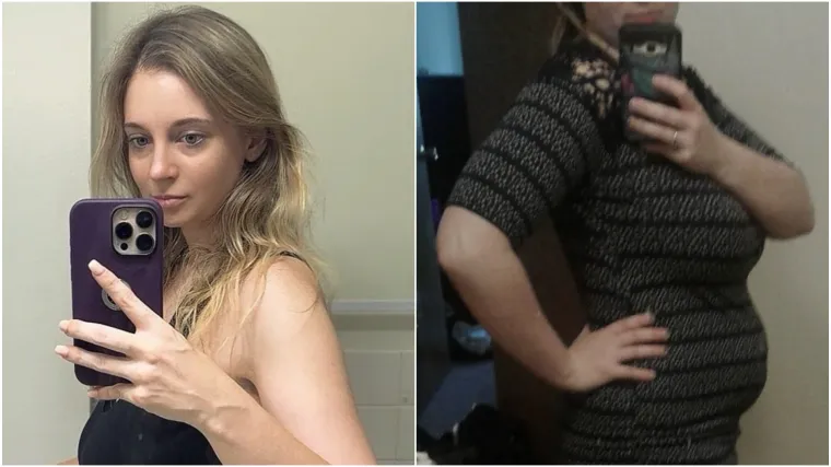 Nakon poroda nije mogla smr&scaron;avjeti, dijagnozu je otkrila slučajno: 'Osjećala sam jaku bol'