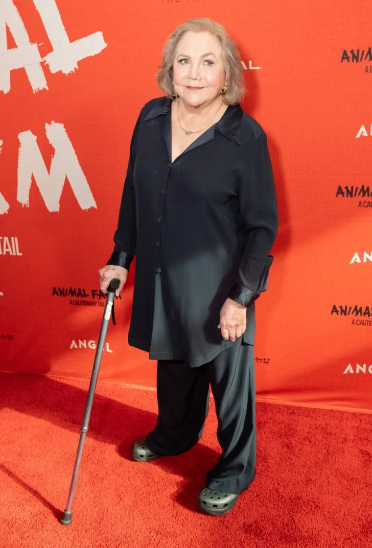 Bila je seks simbol 80-ih, a danas izgleda neprepoznatljivo: Nove fotografije rastužile fanove