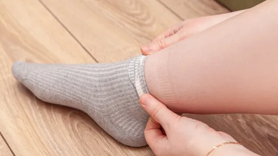 Čarape vam ostavljaju tragove na nogama? Liječnici otkrivaju &scaron;to to znači i je li opasno