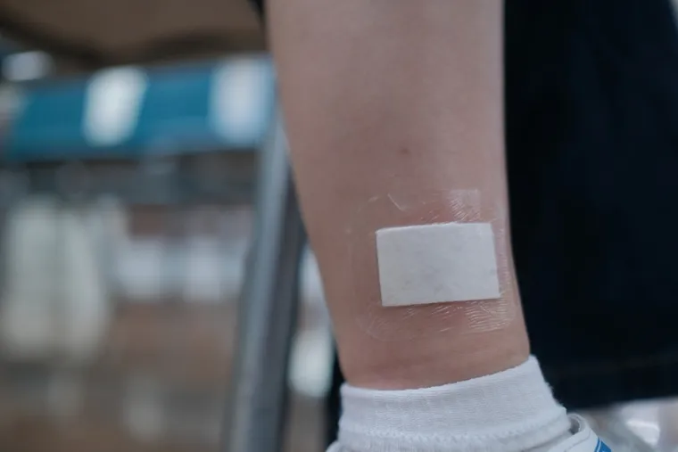 Čarape vam ostavljaju tragove na nogama? Liječnici otkrivaju &scaron;to to znači i je li opasno