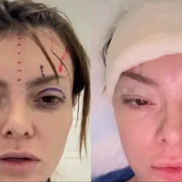 Ella Dvornik progovorila o &scaron;avovima i podljevima: 'Izgledala sam kao iz Slagalice strave'