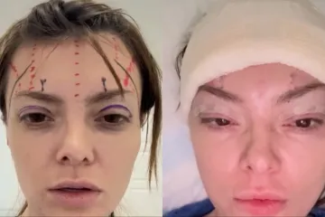 Ella Dvornik progovorila o &scaron;avovima i podljevima: 'Izgledala sam kao iz Slagalice strave'