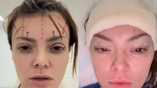 Ella Dvornik progovorila o &scaron;avovima i podljevima: 'Izgledala sam kao iz Slagalice strave