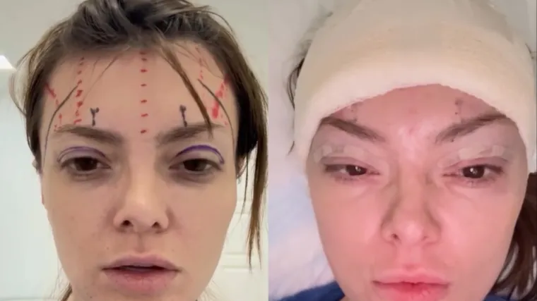 Ella Dvornik progovorila o &scaron;avovima i podljevima: 'Izgledala sam kao iz Slagalice strave