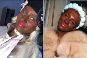 Ovisna je o solariju do te mjere da si je unakazila kožu, a ba&scaron; je bila slatka djevojka