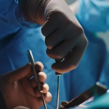 Prvi put izvedena operacija aneurizme aorte minimalno invazivnom metodom u Bjelovaru