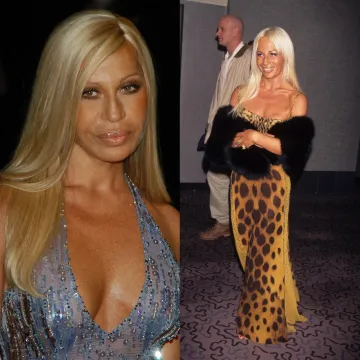 Ubojstvo brata slomilo je Donatellu Versace, a spas je tražila u kokainu i estetskim operacijama