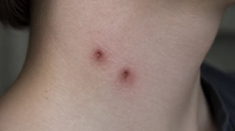 Vampirima na komuniste: Vojska otkrila da se i na naizgled bizarne načine borila protiv petokrake