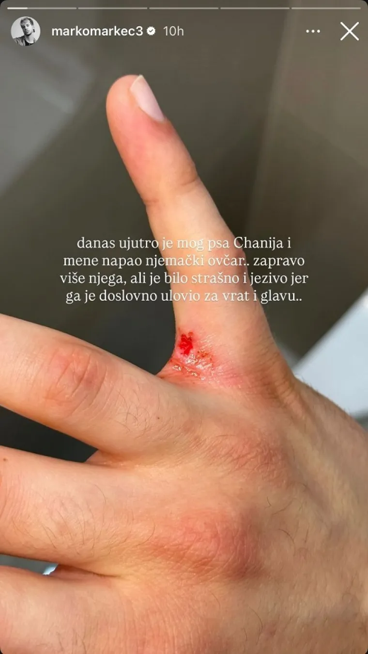Agresivni pas napao domaćeg influencera i njegovog ljubimca: 'Bilo je stra&scaron;no i jezivo'