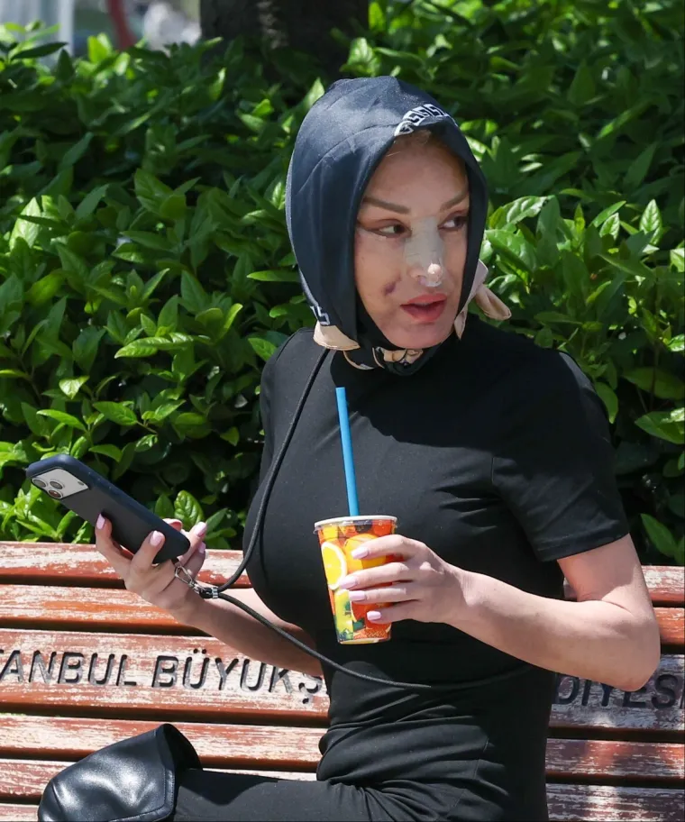 Svi gledaju i ne vjeruju &scaron;to je napravila od sebe: Reality zvijezda sablaznila novim izgledom