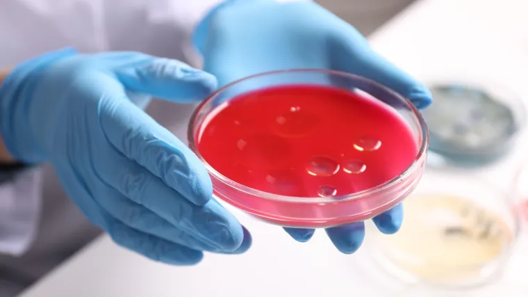 Ponovno se pojavio smrtonosni virus: Potvrdili epidemiju, već je 65 mrtvih