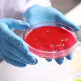 Ponovno se pojavio smrtonosni virus: Potvrdili epidemiju, već je 65 mrtvih