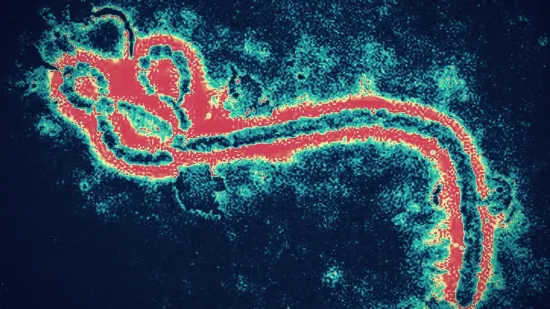 Smrtonosna bolest izaziva strah: 'Duboko sam zabrinut zbog &scaron;irenja epidemije'