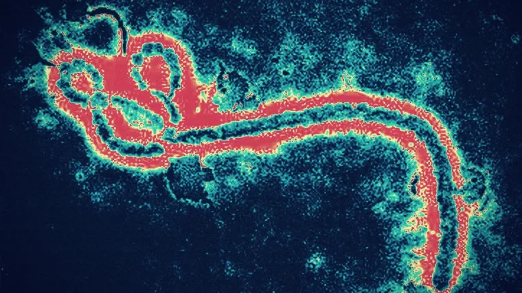 Smrtonosna bolest izaziva strah: 'Duboko sam zabrinut zbog &scaron;irenja epidemije'