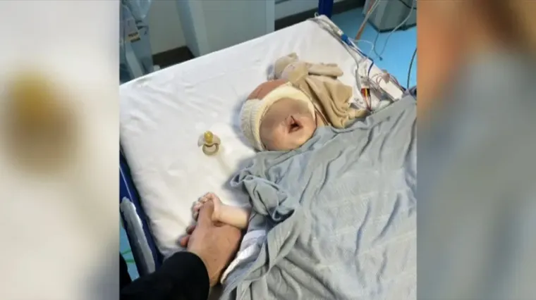 Na porodu otac počeo vri&scaron;tati, primalja protrnula u &scaron;oku: Dječak u Sloveniji spava otvorenih očiju