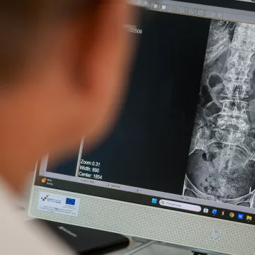 Kronična bol u leđima ne smije biti svakodnevica - upoznajte stručnjake koji pacijentima vraćaju normalan san, kretanje i život
