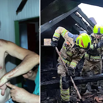 Požar u domu nekada&scaron;njeg sudionika 'Večere za pet': Aldo je sam poku&scaron;ao ugasiti vatru, &scaron;teta je velika