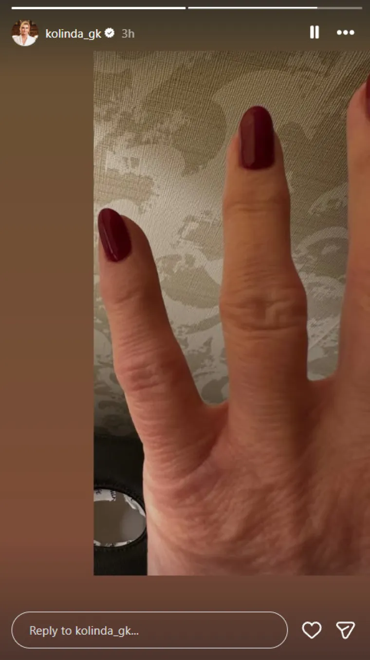 &Scaron;ok nakon fotografije ozlijeđenog prsta: Kolinda upozorila na opasnost koju mnogi ignoriraju