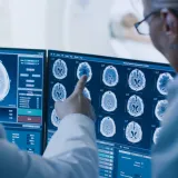 Neurokirurg otkriva pet navika za održavanje mozga zdravim: 'Pobolj&scaron;ava zdravlje'