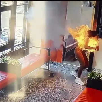 Influencerica se borila za život zbog uređaja koji svi koristimo: 'Čula sam pucketanje'