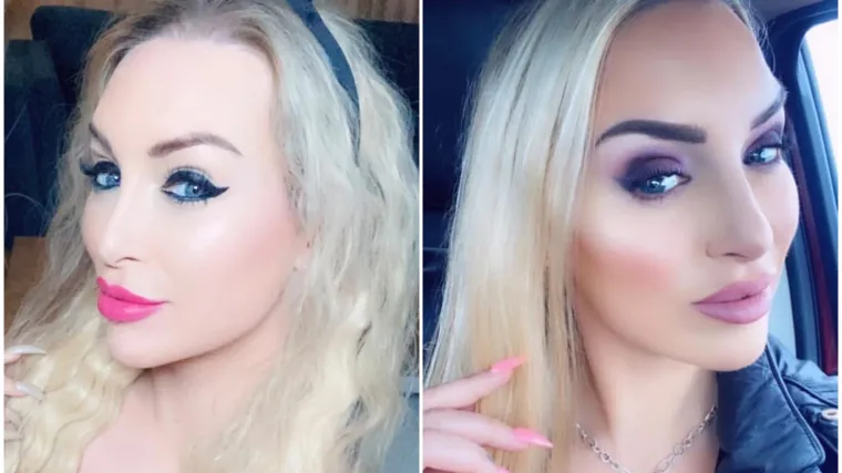 Potro&scaron;ila je bogatstvo da bi bila Barbie: Sada ulaže jo&scaron; vi&scaron;e kako bi vratila prirodan izgled