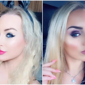 Potro&scaron;ila je bogatstvo da bi bila Barbie: Sada ulaže jo&scaron; vi&scaron;e kako bi vratila prirodan izgled