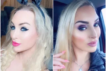 Potro&scaron;ila je bogatstvo da bi bila Barbie: Sada ulaže jo&scaron; vi&scaron;e kako bi vratila prirodan izgled