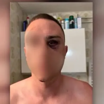 Policija otkrila &scaron;to je bio okidač napada na Slovence u Medulinu: Jedan uhićen, trojica u bijegu