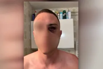 Policija otkrila &scaron;to je bio okidač napada na Slovence u Medulinu: Jedan uhićen, trojica u bijegu