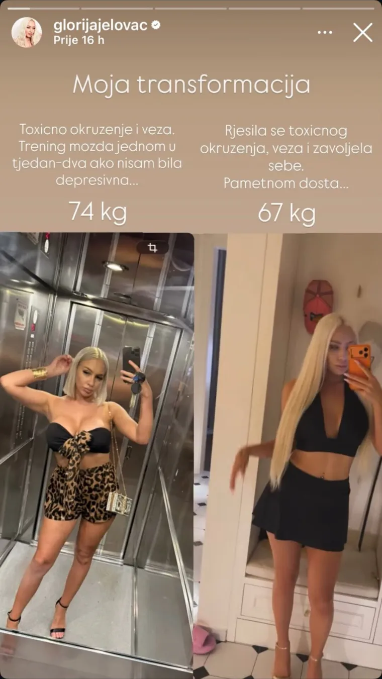 Glorija iz 'Gospodina Savr&scaron;enog' pokazala novu liniju i otkrila kako joj je to uspjelo