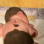 Madeži joj prekrivaju skoro cijelo tijelo: Ne srami se, ponosno ih pokazuje i u bikiniju