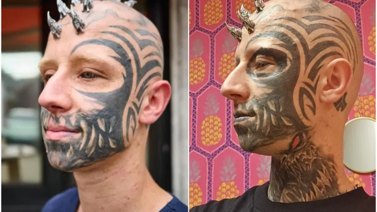 Slijepi mu&scaron;karac s metalom u glavi i crnim očima &scaron;okira pojavom: Evo kako je izgledao prije