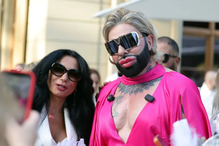 Tko je mu&scaron;karac koji je u svoj izgled uložio oko 600.000 eura? Uspoređuju ga s Katie Price