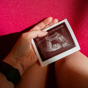 Doživjela je spontani pobačaj: 'Liječnici su mi odbijali pregled, sada se bojim ostati trudna'