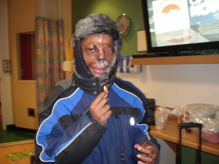 Spavao je sa psima, a onda su ga napala dva pit bulla: 'Vri&scaron;tao sam, ali nitko me nije čuo'